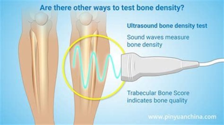 At what age should you stop getting bone density tests? |