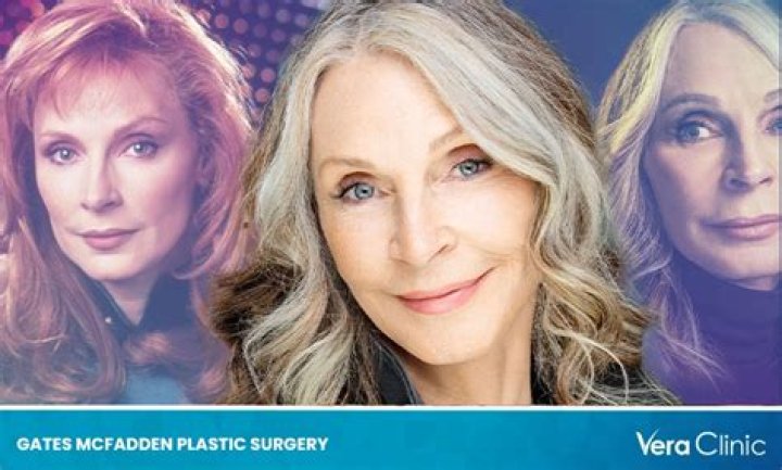 Gates McFadden's Plastic Surgery Journey Revealed