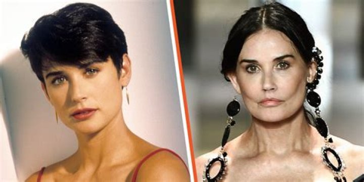 Has Sandra Bullock Had Plastic Surgery Inside?