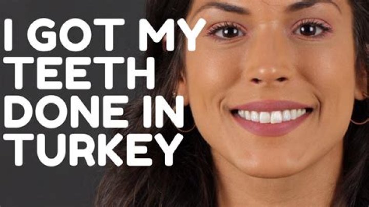 The Challenge: Has Nany had her teeth done? Truth behind appearance revealed Thu 25 March 2021