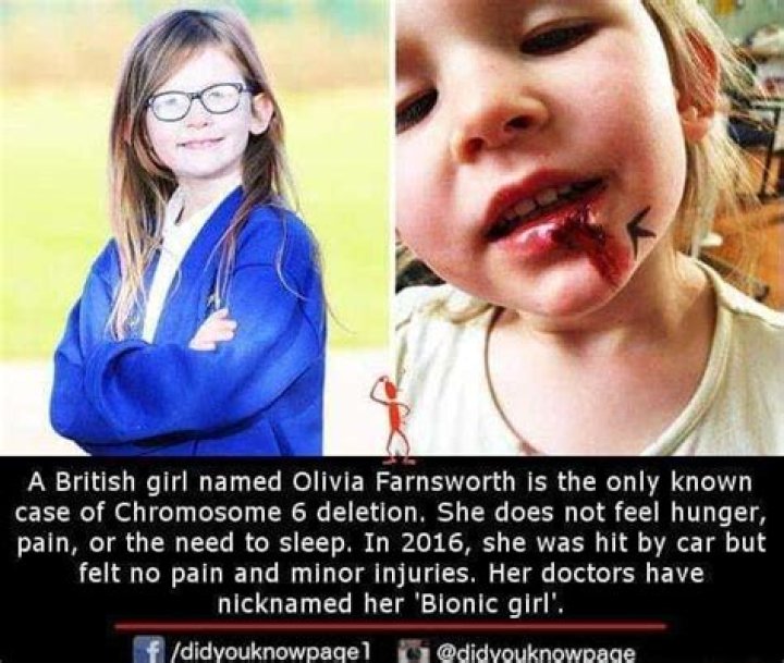 Olivia Farnsworth Wikipedia : Everything To Know About The Girl With A Rare Chromosome 6 Deletion